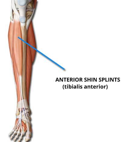 ปวดสันหน้าแข้งด้านหน้า (Anterior shin splints) 
