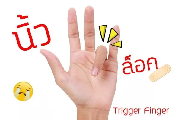 นิ้วล็อค แบบนี้ไม่เลิฟแน่ !!!