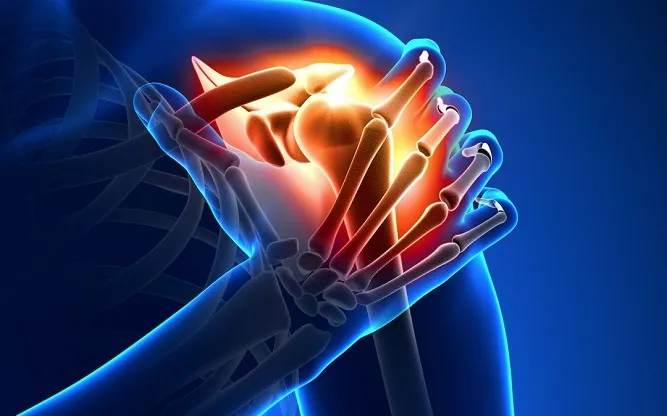เอ็นข้อไหล่ด้านหน้าอักเสบ (Subscapularis Tendinitis)