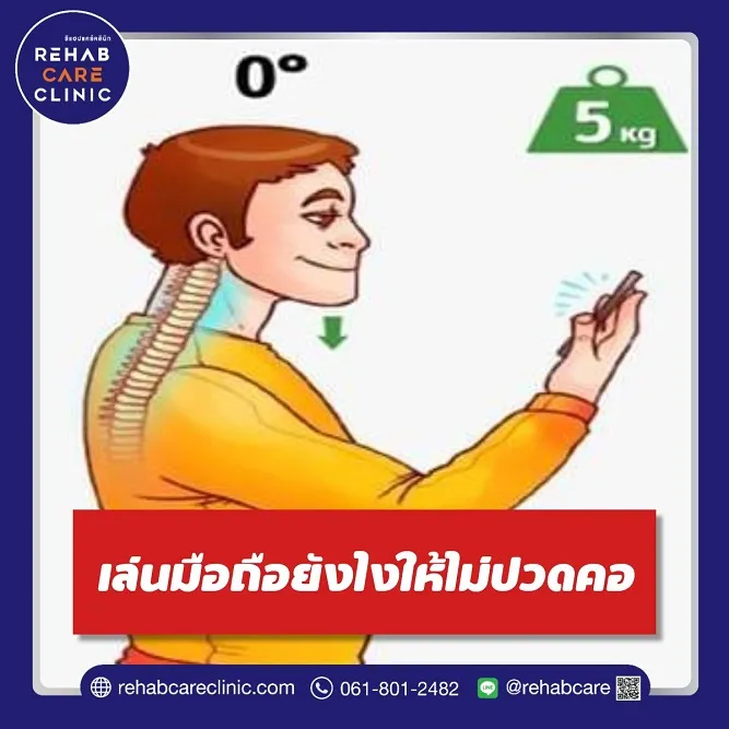 เล่นมือถือหรือคอมพิวเตอร์อย่างไร ไม่ให้ปวดคอ?