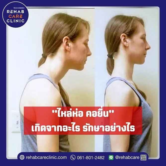 ไหล่ห่อคอยื่น เกิดจากอะไรแก้ได้อย่างไร?