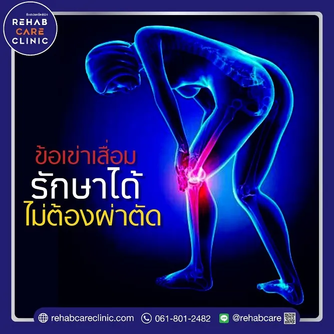 ข้อเข่าเสื่อม รักษาได้โดยไม่ต้องผ่าตัด