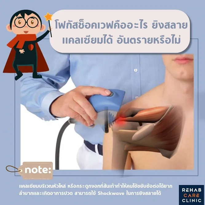 โฟกัสช็อคเวฟคืออะไร