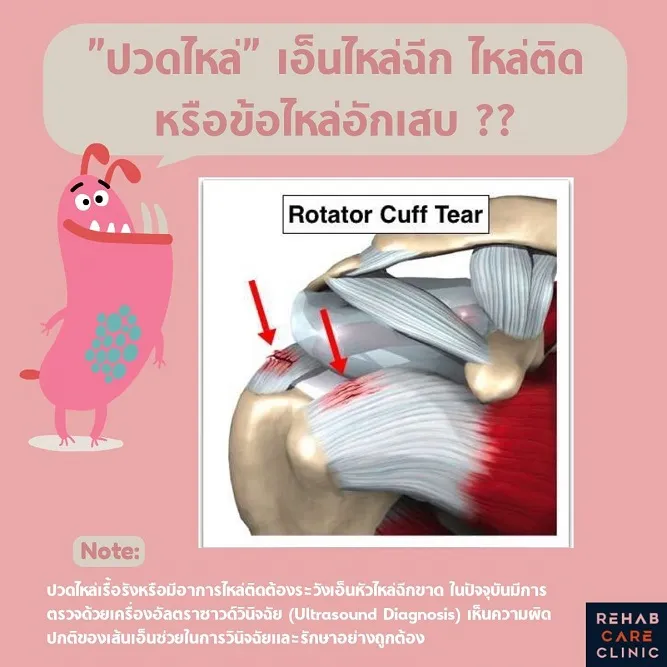 “ปวดไหล่” เอ็นไหล่ฉีก ไหล่ติด หรือข้อไหล่อักเสบ ??